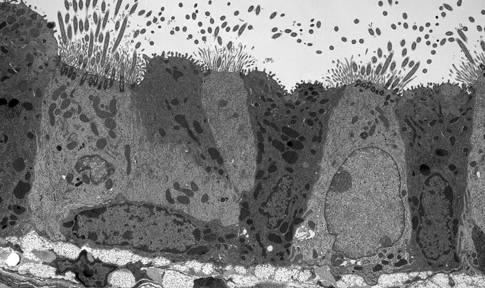 A thin section cut through the bronchiolar epithelium of a mouse lung, which consists of ciliated cells and non-ciliated cells. 